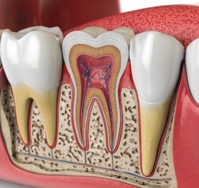 Animated smile showing the inside of a tooth before pulp therapy