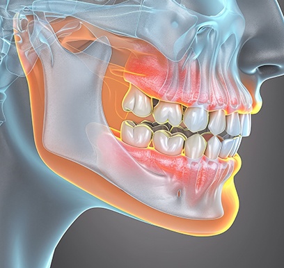 Digital illustration of human jaw